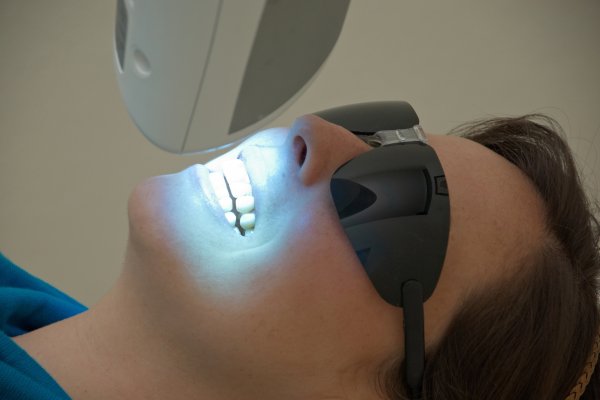 Teeth Whitening Options For Gray Teeth