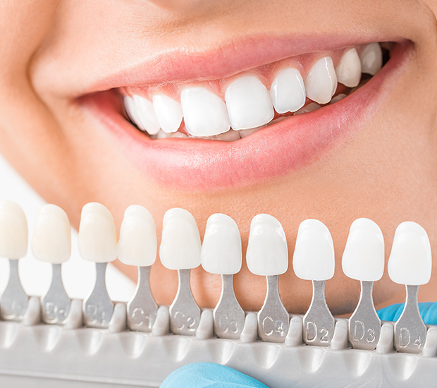 Reasons To Get At Home Teeth Whitening Custom Trays From Your Dentist