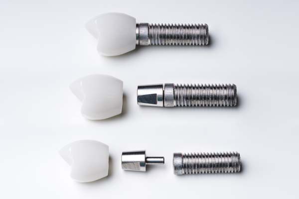 Why An Experienced Implant Dentist Wants You To Care For Your Dental Implants