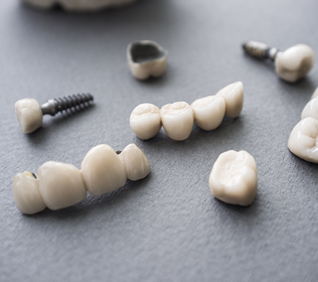 Albuquerque The Difference Between Dental Implants and Mini Dental Implants