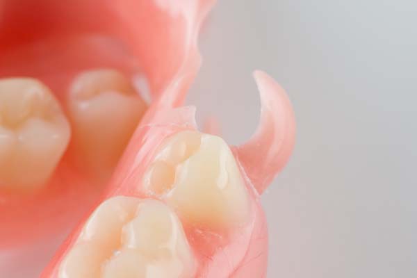 When Does A Dentist Use Partial Dentures To Replace Missing Teeth?