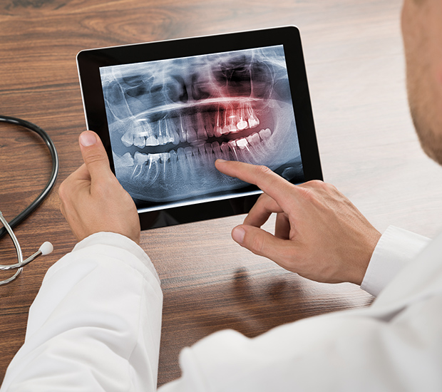 Albuquerque Types of Dental Root Fractures